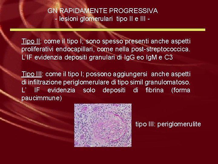 GN RAPIDAMENTE PROGRESSIVA - lesioni glomerulari tipo II e III Tipo II: come il