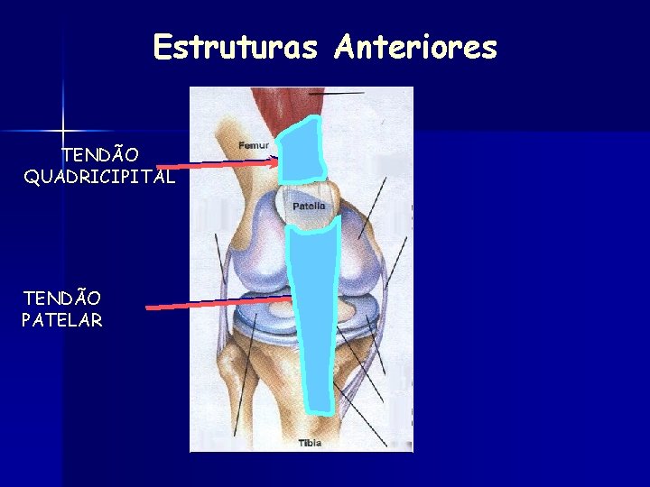Estruturas Anteriores TENDÃO QUADRICIPITAL TENDÃO PATELAR 
