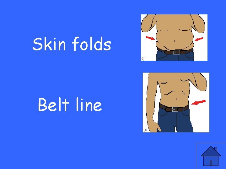 Skin folds Belt line 