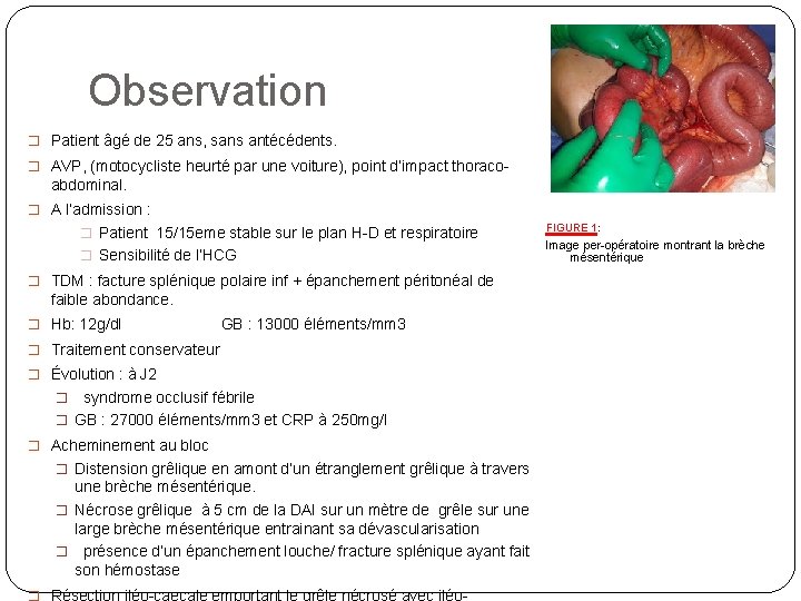 Observation � Patient âgé de 25 ans, sans antécédents. � AVP, (motocycliste heurté par