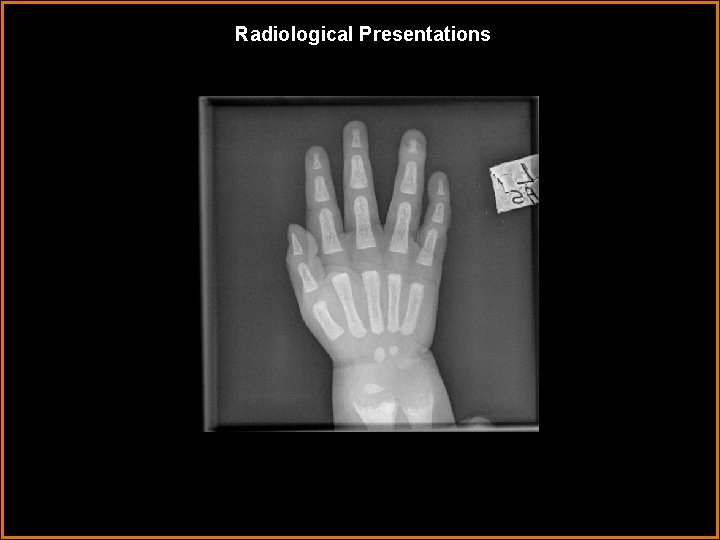 Radiological Presentations 