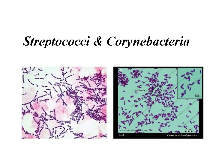 Streptococci & Corynebacteria 