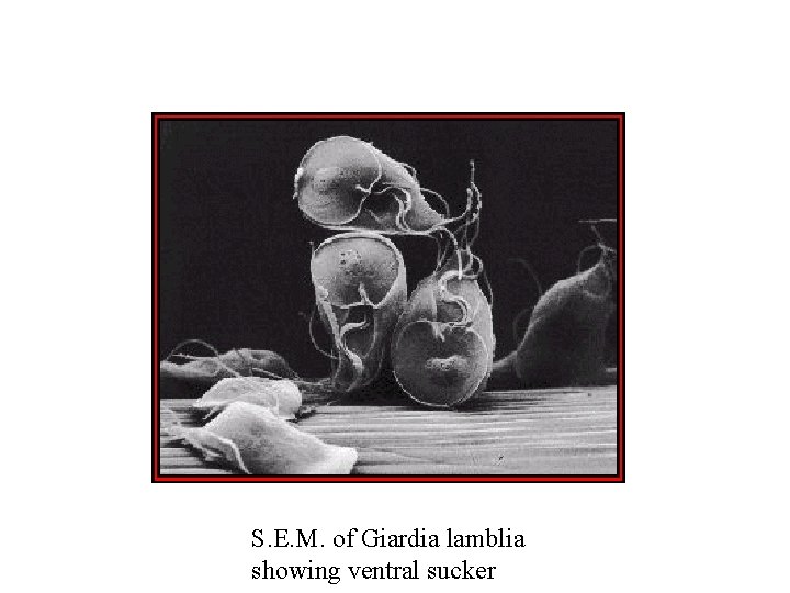 S. E. M. of Giardia lamblia showing ventral sucker S. E. M. of Giardia lamblia showing ventral sucker
