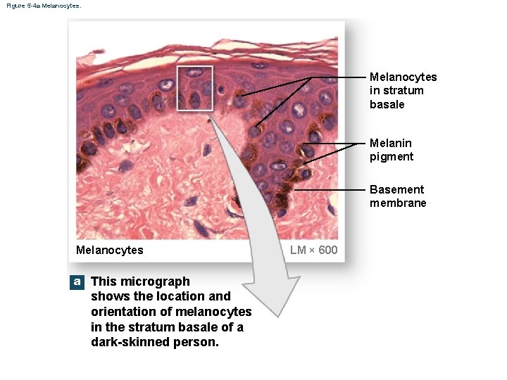 Figure 5 -4 a Melanocytes in stratum basale Melanin pigment Basement membrane Melanocytes a