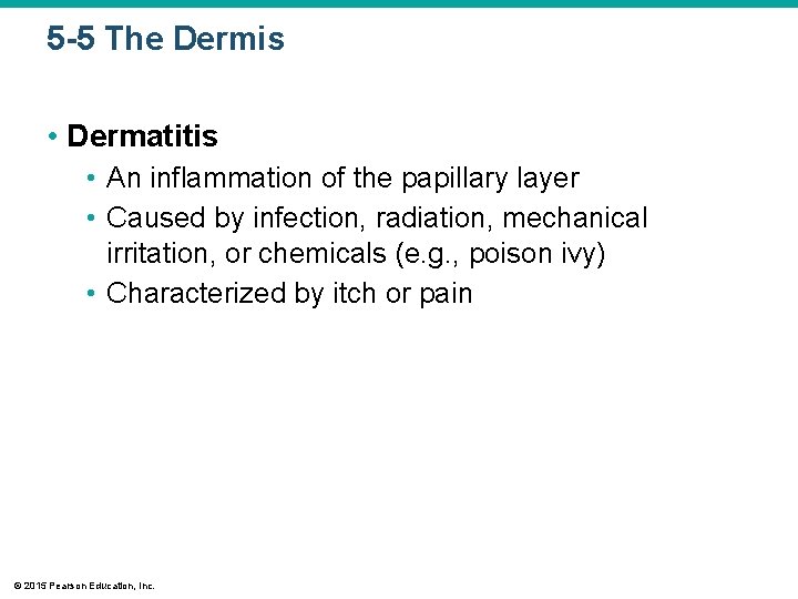 5 -5 The Dermis • Dermatitis • An inflammation of the papillary layer •