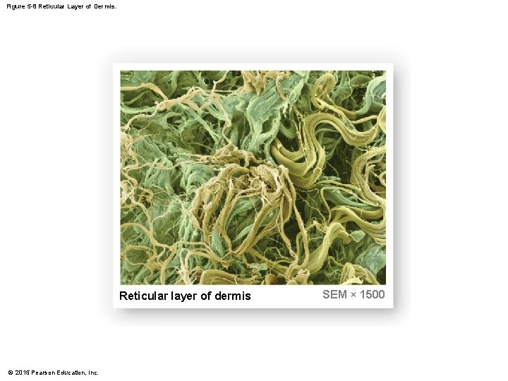 Figure 5 -8 Reticular Layer of Dermis. Reticular layer of dermis © 2015 Pearson