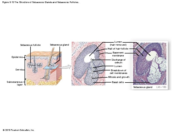 Figure 5 -13 The Structure of Sebaceous Glands and Sebaceous Follicles. Sebaceous follicle Sebaceous