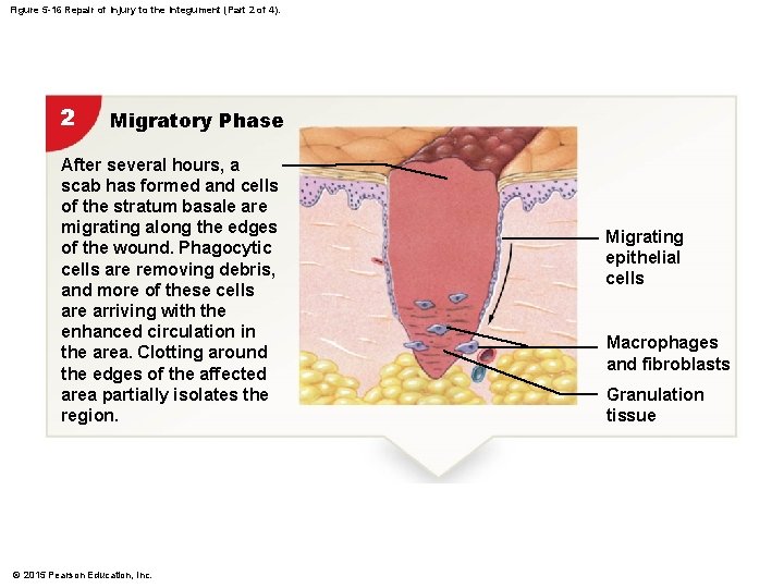 Figure 5 -16 Repair of Injury to the Integument (Part 2 of 4). 2