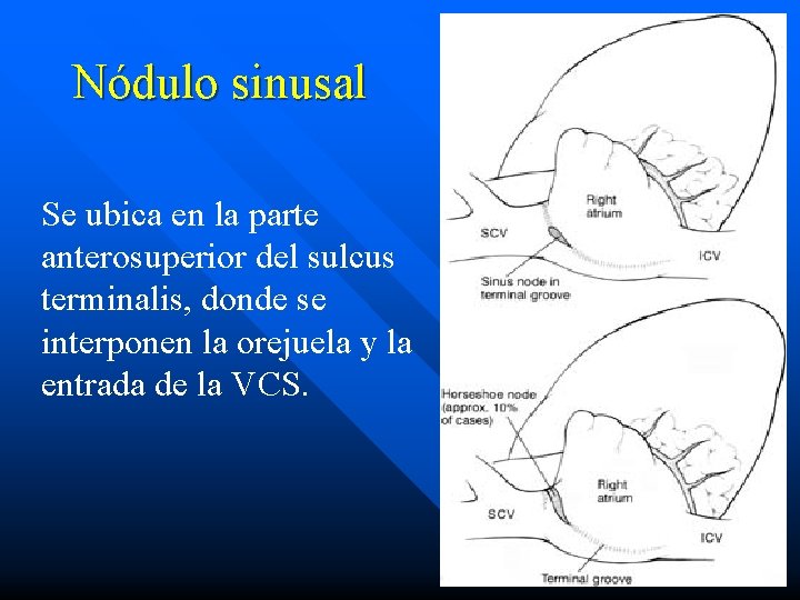 Nódulo sinusal Se ubica en la parte anterosuperior del sulcus terminalis, donde se interponen