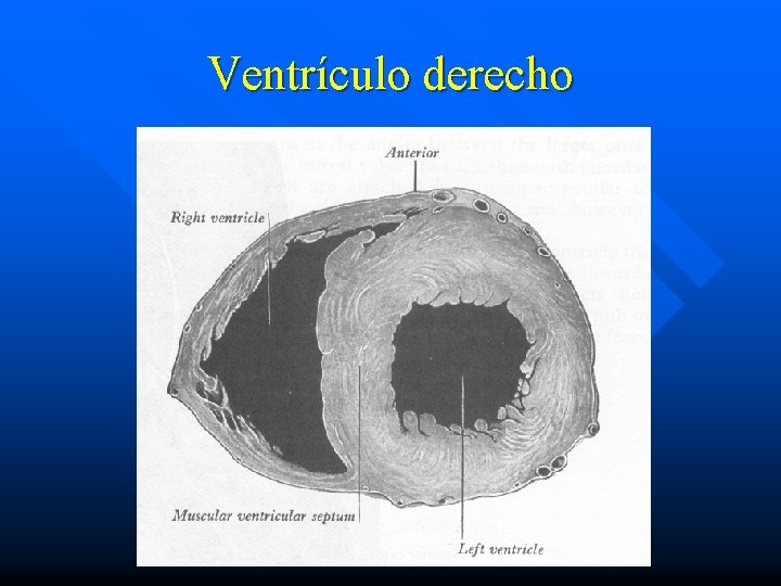 Ventrículo derecho 