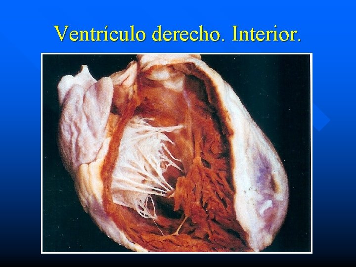 Ventrículo derecho. Interior. 