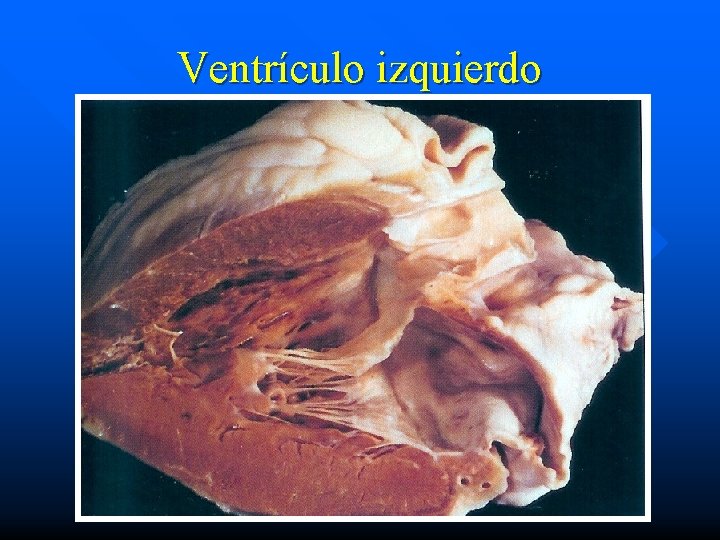 Ventrículo izquierdo 