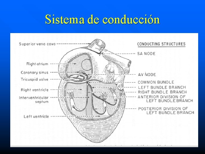 Sistema de conducción 