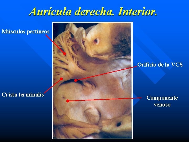 Aurícula derecha. Interior. Músculos pectíneos Orificio de la VCS Crista terminalis Componente venoso 