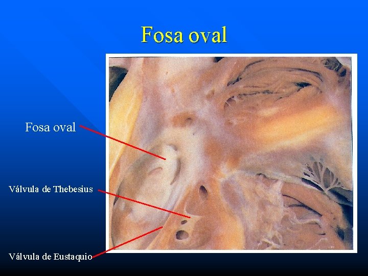 Fosa oval Válvula de Thebesius Válvula de Eustaquio 