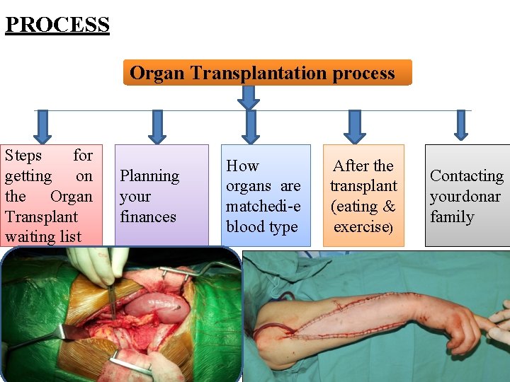 PROCESS Organ • Organ. Transplantationprocess Process Steps for getting on the Organ Transplant waiting