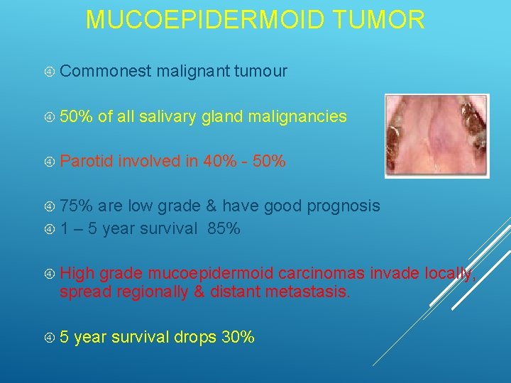 MUCOEPIDERMOID TUMOR Commonest 50% malignant tumour of all salivary gland malignancies Parotid involved in
