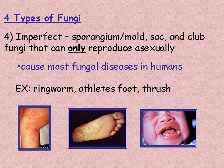 4 Types of Fungi 4) Imperfect – sporangium/mold, sac, and club fungi that can