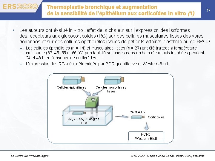 Thermoplastie bronchique et augmentation de la sensibilité de l’épithélium aux corticoïdes in vitro (1)