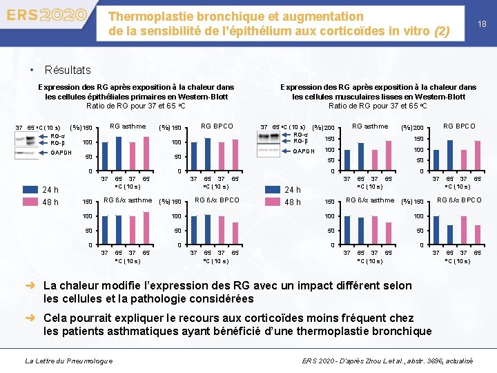 Thermoplastie bronchique et augmentation de la sensibilité de l’épithélium aux corticoïdes in vitro (2)