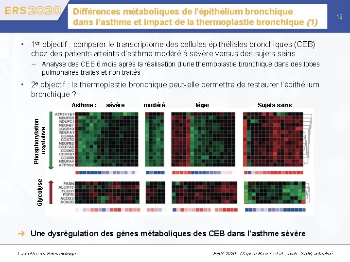 Différences métaboliques de l’épithélium bronchique dans l’asthme et impact de la thermoplastie bronchique (1)