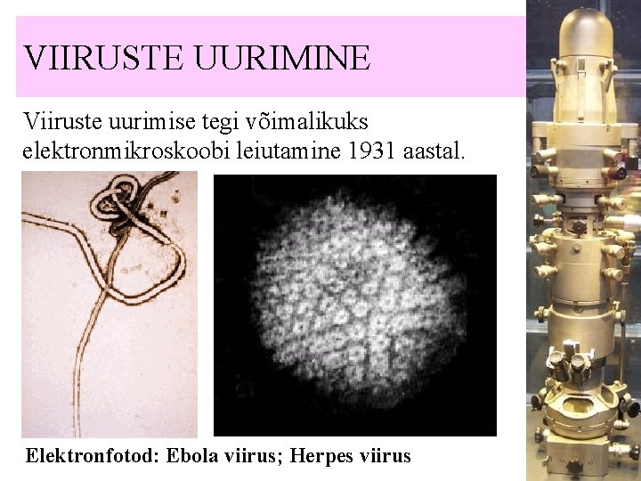 VIIRUSTE UURIMINE Viiruste uurimise tegi võimalikuks elektronmikroskoobi leiutamine 1931 aastal. Elektronfotod: Ebola viirus; Herpes