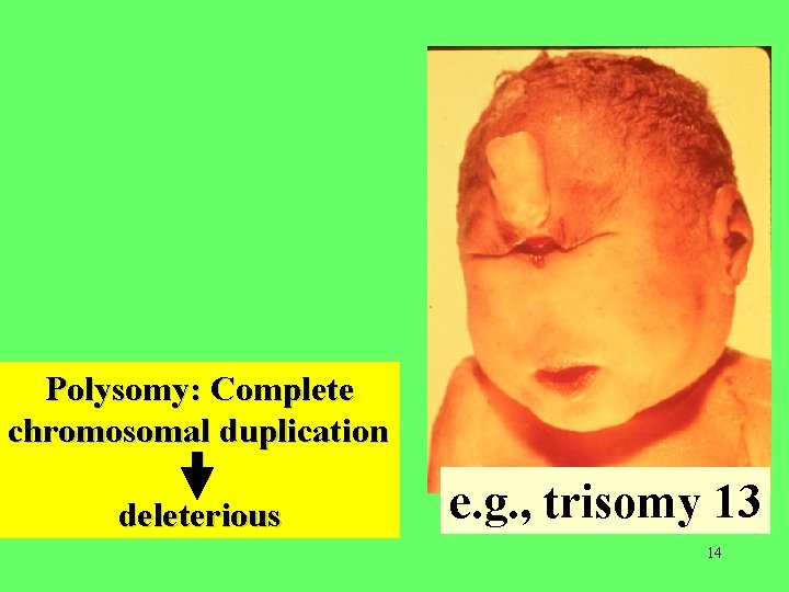 Polysomy: Complete chromosomal duplication deleterious e. g. , trisomy 13 14 