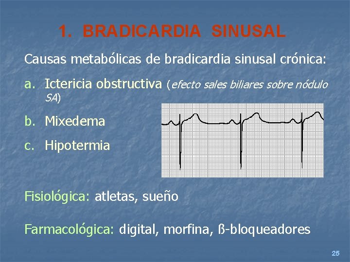1. BRADICARDIA SINUSAL Causas metabólicas de bradicardia sinusal crónica: a. Ictericia obstructiva (efecto sales
