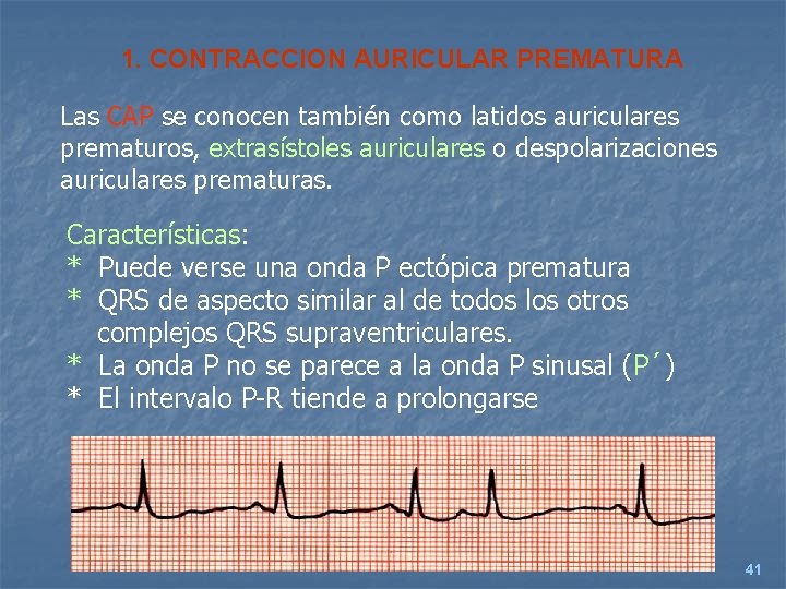 1. CONTRACCION AURICULAR PREMATURA Las CAP se conocen también como latidos auriculares prematuros, extrasístoles