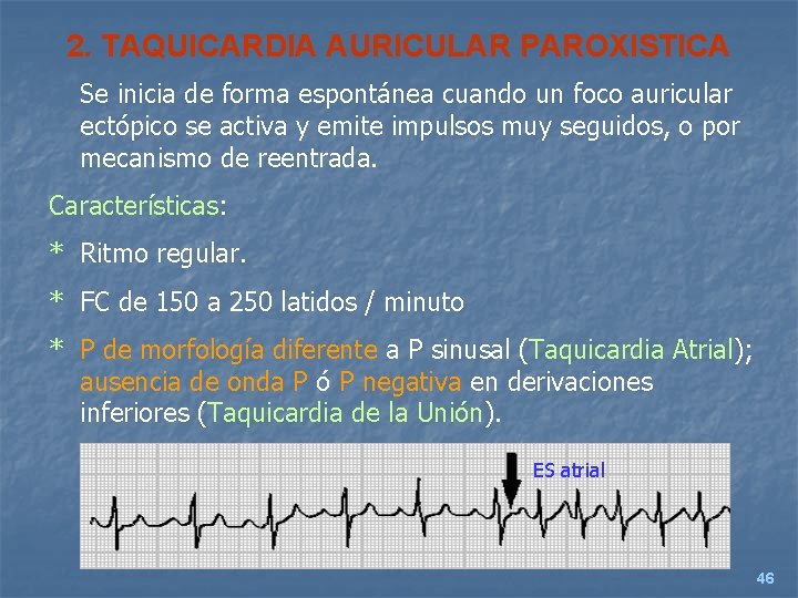 2. TAQUICARDIA AURICULAR PAROXISTICA Se inicia de forma espontánea cuando un foco auricular ectópico