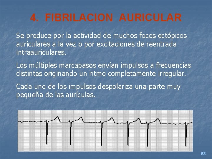 4. FIBRILACION AURICULAR Se produce por la actividad de muchos focos ectópicos auriculares a