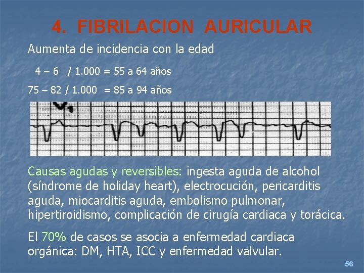 4. FIBRILACION AURICULAR Aumenta de incidencia con la edad 4 – 6 / 1.