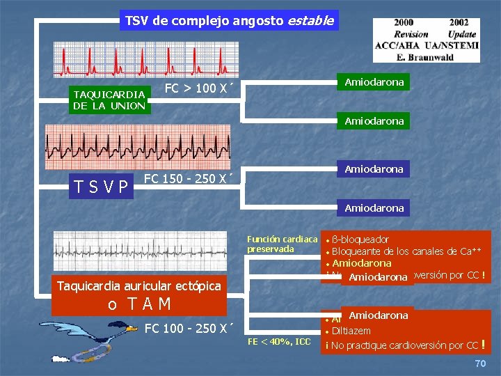 TSV de complejo angosto estable TAQUICARDIA DE LA UNION Amiodarona FC > 100 X´