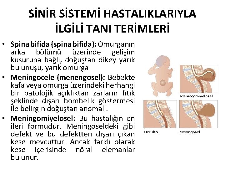 SİNİR SİSTEMİ HASTALIKLARIYLA İLGİLİ TANI TERİMLERİ • Spina bifida (spina bifida): Omurganın arka bölümü