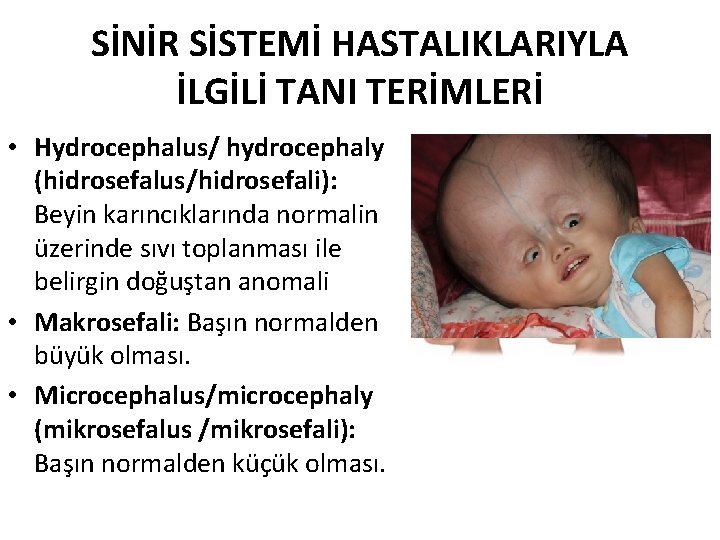 SİNİR SİSTEMİ HASTALIKLARIYLA İLGİLİ TANI TERİMLERİ • Hydrocephalus/ hydrocephaly (hidrosefalus/hidrosefali): Beyin karıncıklarında normalin üzerinde