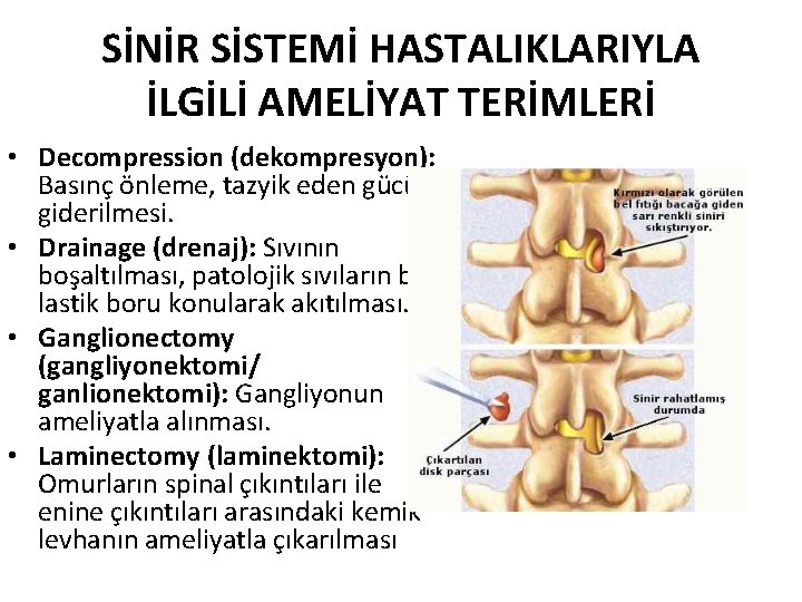 SİNİR SİSTEMİ HASTALIKLARIYLA İLGİLİ AMELİYAT TERİMLERİ • Decompression (dekompresyon): Basınç önleme, tazyik eden gücün