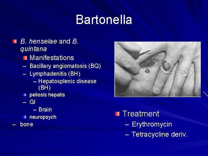Bartonella B. henselae and B. quintana Manifestations – Bacillary angiomatosis (BQ) – Lymphadenitis (BH)