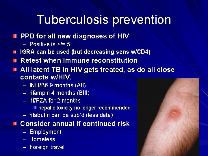 Tuberculosis prevention PPD for all new diagnoses of HIV – Positive is >/= 5