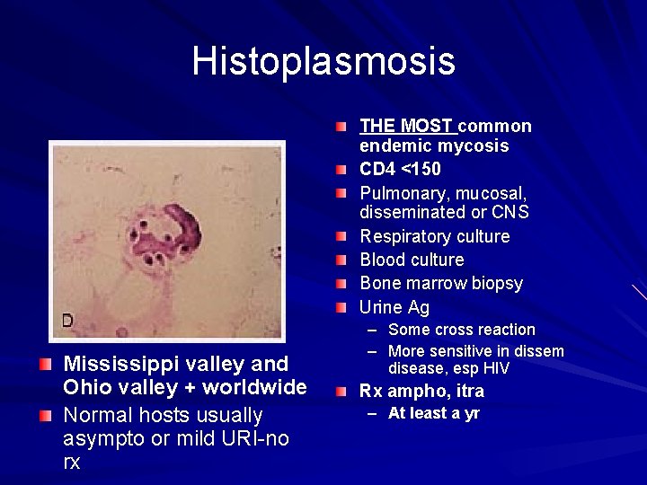 Histoplasmosis THE MOST common endemic mycosis CD 4 <150 Pulmonary, mucosal, disseminated or CNS