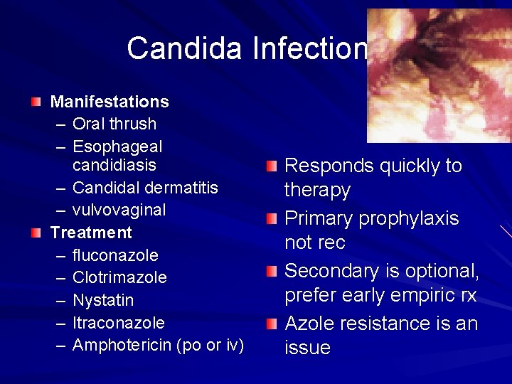 Candida Infections Manifestations – Oral thrush – Esophageal candidiasis – Candidal dermatitis – vulvovaginal