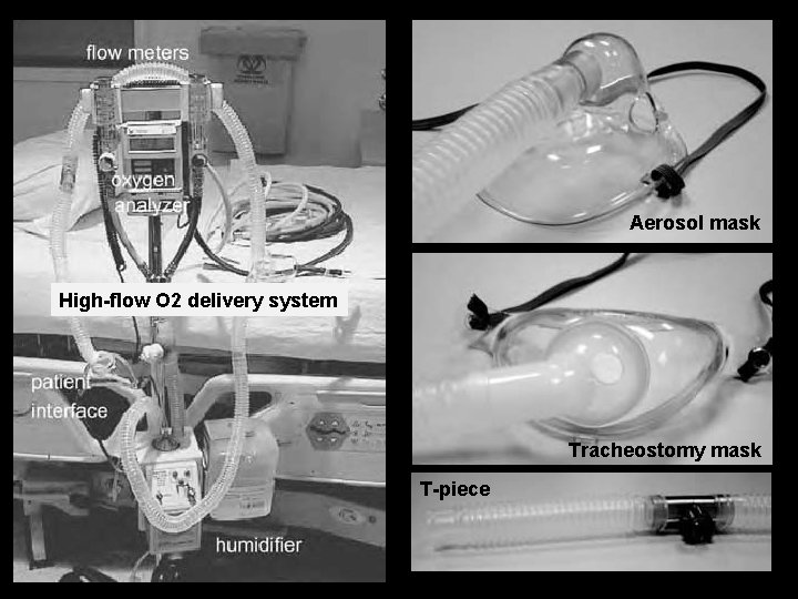 Aerosol mask High-flow O 2 delivery system Tracheostomy mask T-piece 