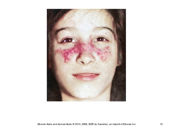 Elsevier items and derived items © 2013, 2009, 2005 by Saunders, an imprint of