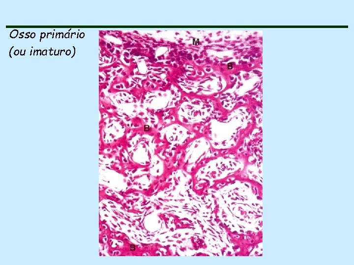 Osso primário (ou imaturo) 