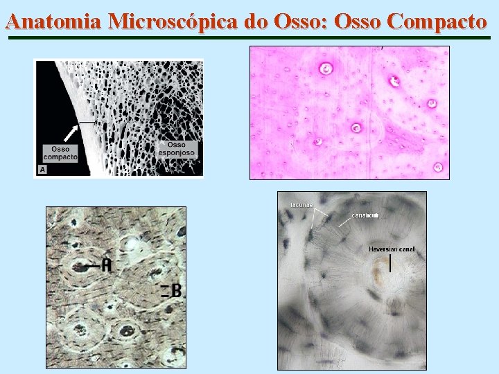 Anatomia Microscópica do Osso: Osso Compacto 