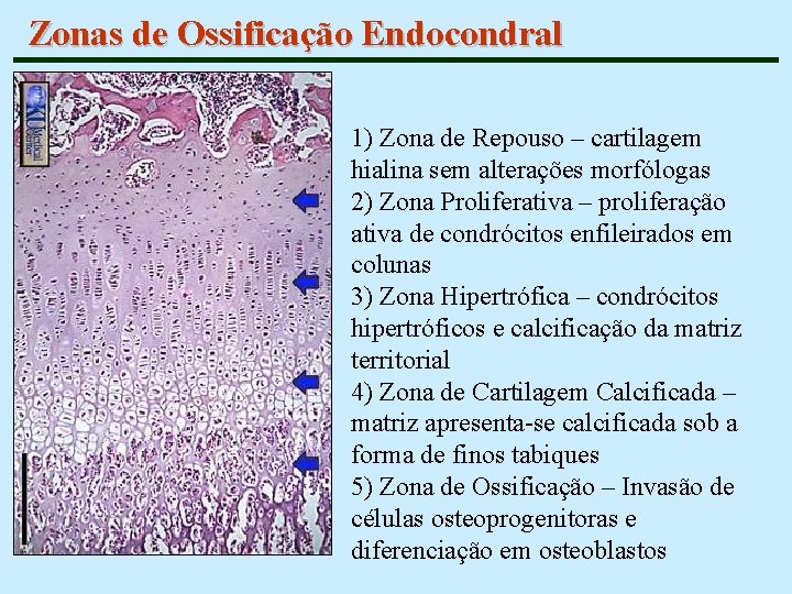 Zonas de Ossificação Endocondral 1) Zona de Repouso – cartilagem hialina sem alterações morfólogas