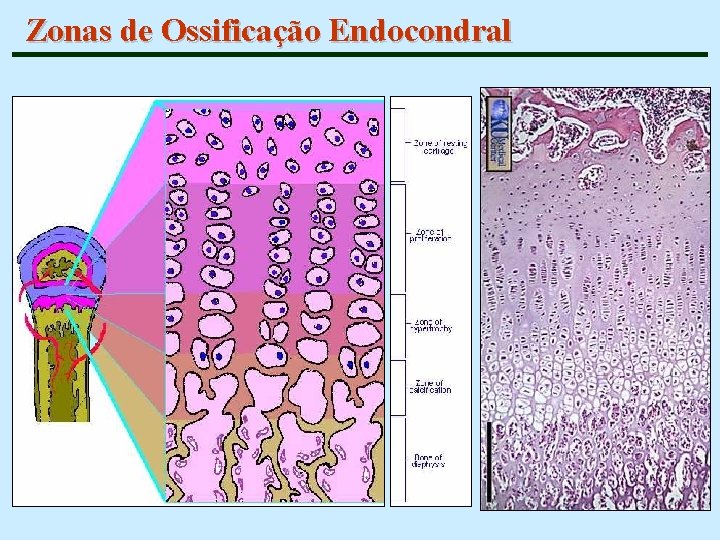 Zonas de Ossificação Endocondral 