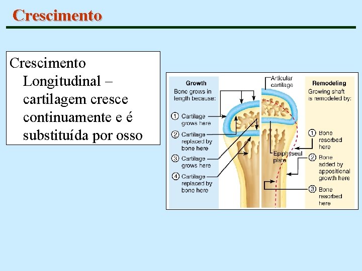 Crescimento Longitudinal – cartilagem cresce continuamente e é substituída por osso 