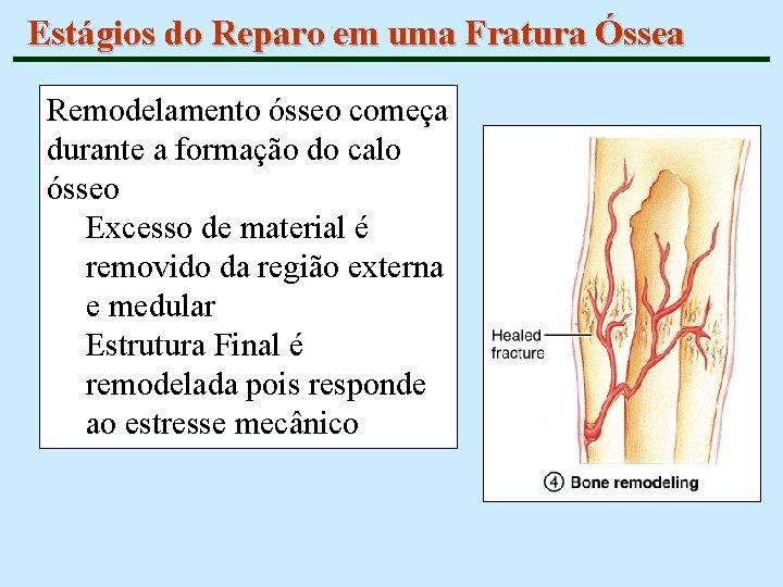 Estágios do Reparo em uma Fratura Óssea Remodelamento ósseo começa durante a formação do