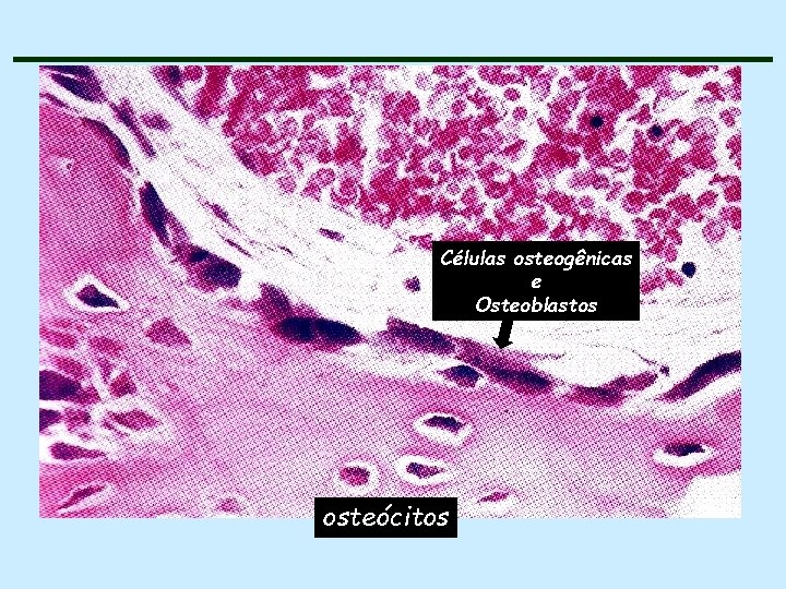 Células osteogênicas e Osteoblastos osteócitos 