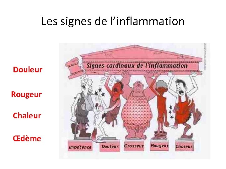 Les signes de l’inflammation Douleur Rougeur Chaleur Œdème 